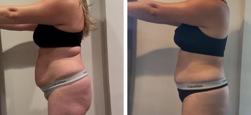 Real FitHer client before and after